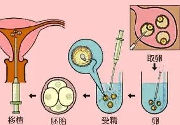 可以找自己姐妹供卵吗-姐妹供卵：这是可以做到的吗？