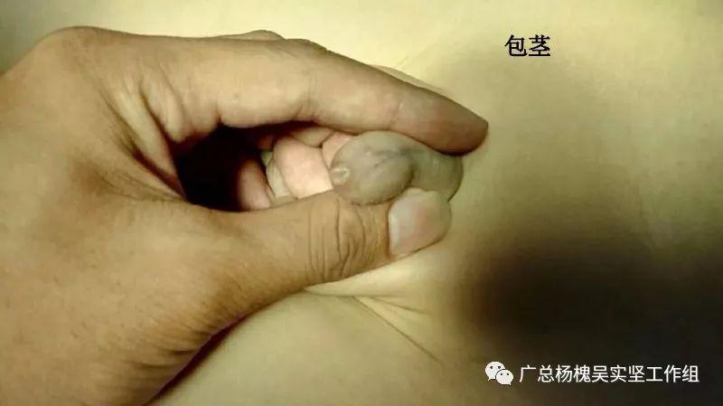 包生男孩过程-包生男孩:一个奇特的成长过程