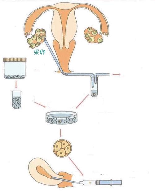 哪里有供卵中心【哪里可以找到可信赖的供卵中心？】