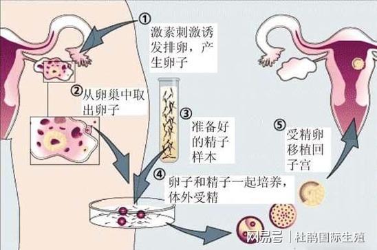供卵自怀_供卵自怀：探讨现代女性的生育选择与困惑”