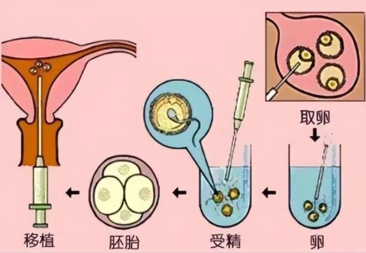 供卵方可以要回孩子吗(供卵方是否有权要回孩子？)